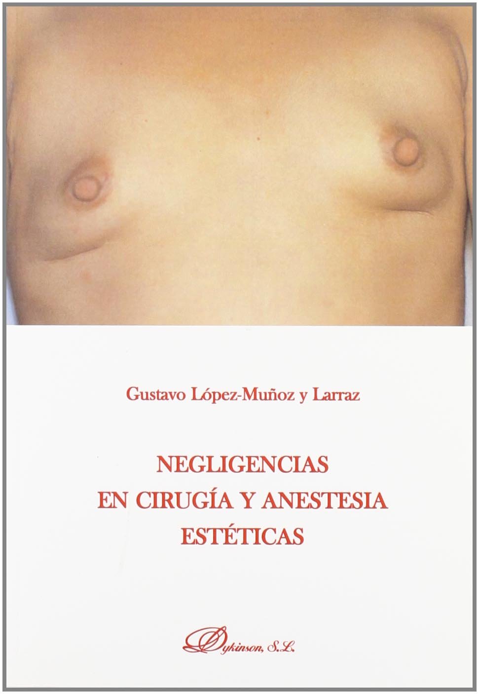 Negligencias En Cirugía Y Anestesia Estéticas