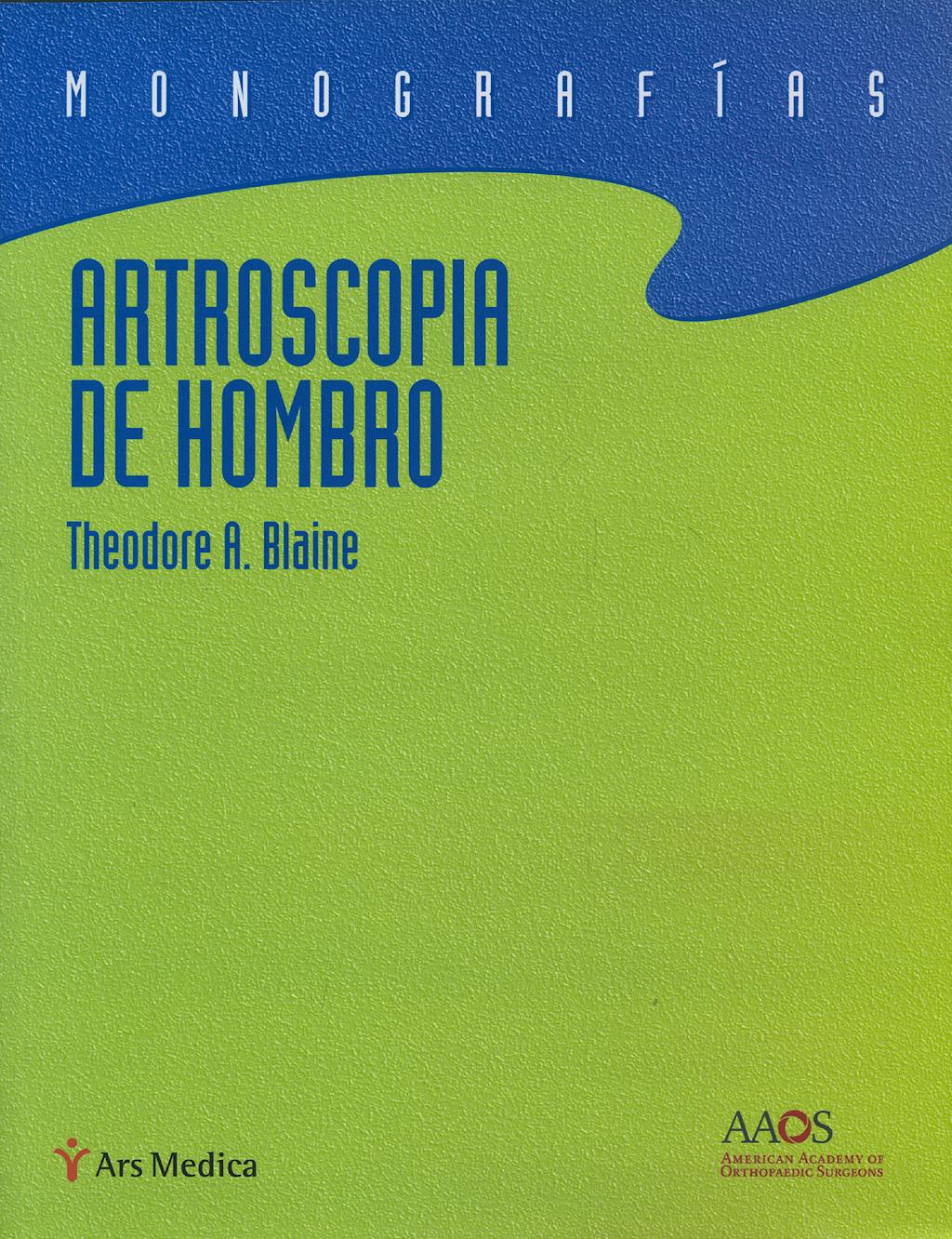 Artroscopia de hombro